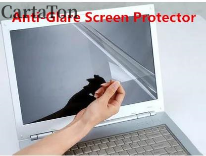 2 шт., матовая защитная пленка – обзор и цена Matte Anti Glare Screen